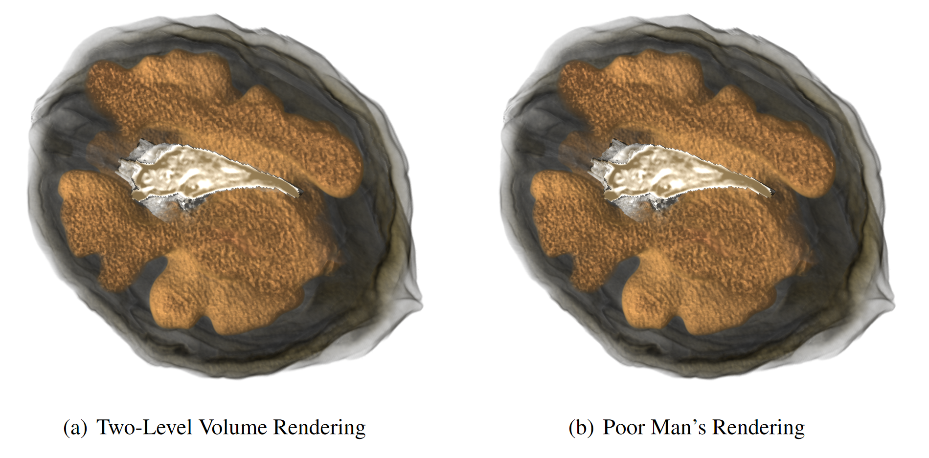 /content/publications/2013_lindholm_bock_segmentation.png